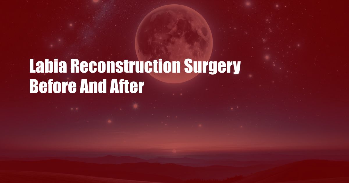 Labia Reconstruction Surgery Before And After