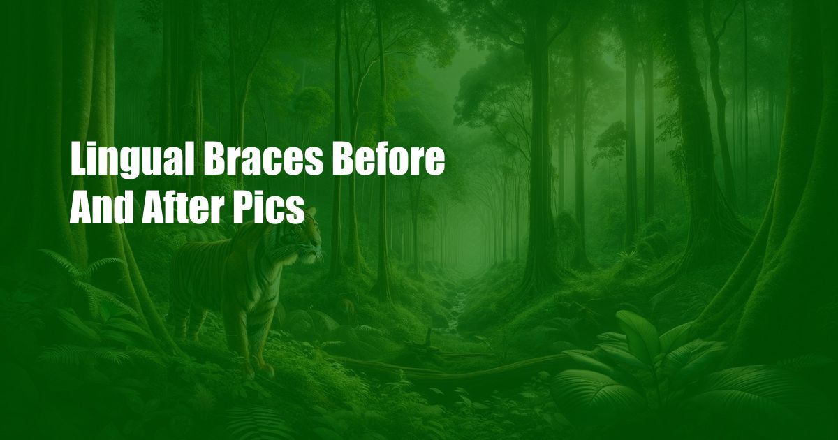 Lingual Braces Before And After Pics